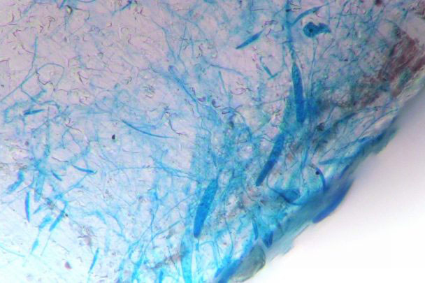 Visit https://www.coastalreview.org/2018/01/study-corals-prefer-taste-plastic/